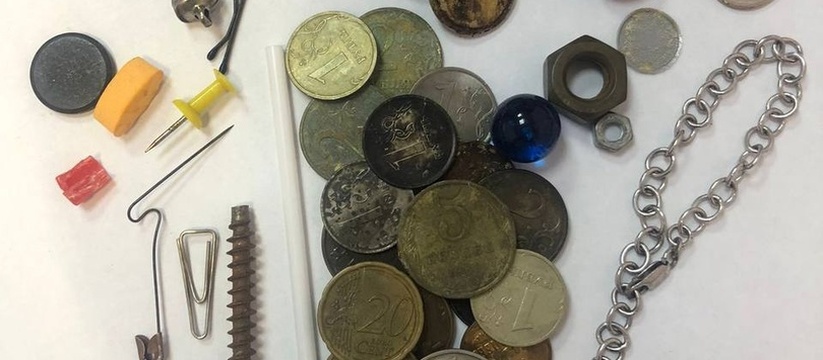 Ключ, браслет и много денег: врачи-эндоскописты горбольницы Новороссийска показали коллекцию вещей, которые они извлекли из желудков маленьких пациентов