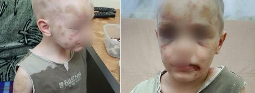 СК возбудил уголовное дело против матери, которая истязала  ребенка в Новороссийске