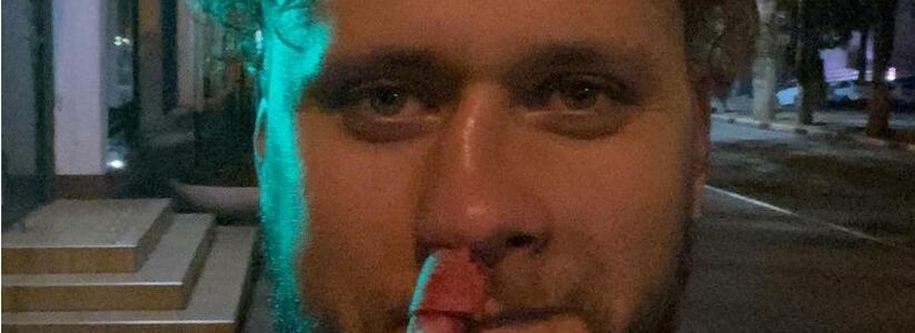 Солисту кавер-группы «Бакс Бани» сломали нос во время концерта в Геленджике
