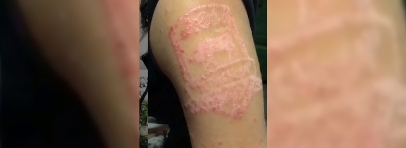 Ребёнок получил химический ожог от пляжной татуировки: новороссийцы обсуждают видео