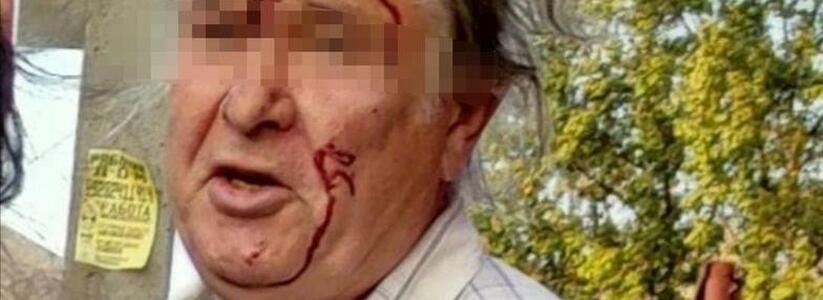 «Ему не понравился цвет ее одежды»: в Новороссийске мужчина ударил 11-летнюю девочку кулаком в лицо