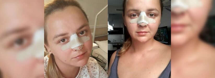 Жена футболиста Мамаева оплатила лечение девушки из Новороссийска, пострадавшей от рук «Доктора Франкенштейна»