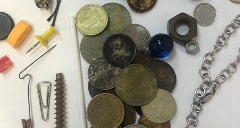 Ключ, браслет и много денег: врачи-эндоскописты горбольницы Новороссийска показали коллекцию вещей, которые они извлекли из желудков маленьких пациентов