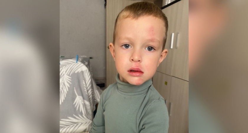 «У него ссадины, гематома во рту и надорвана слизистая!»: в Новороссийске 5-летнего малыша сбил велосипедист 