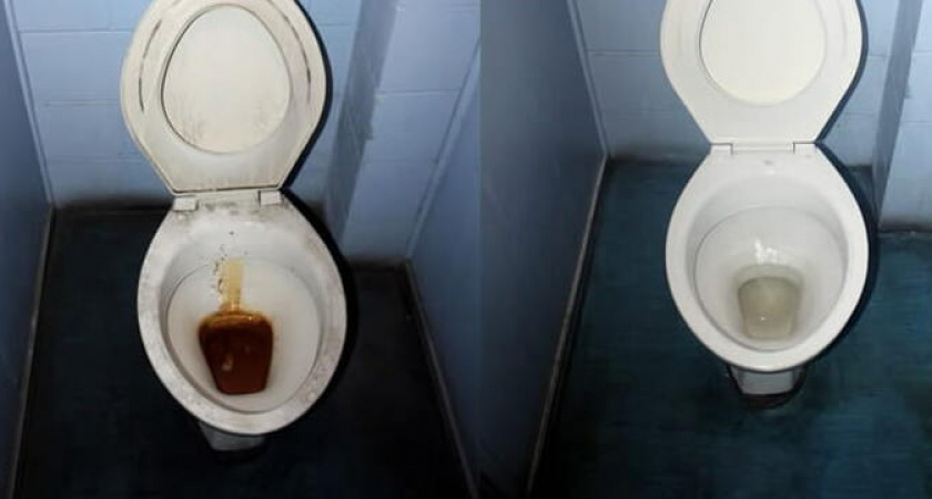 Засыпьте в унитаз это, и он станет белым, как из магазина