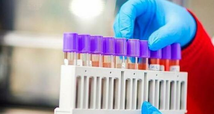 На Кубани число заболевших коронавирусом увеличилось до девяти