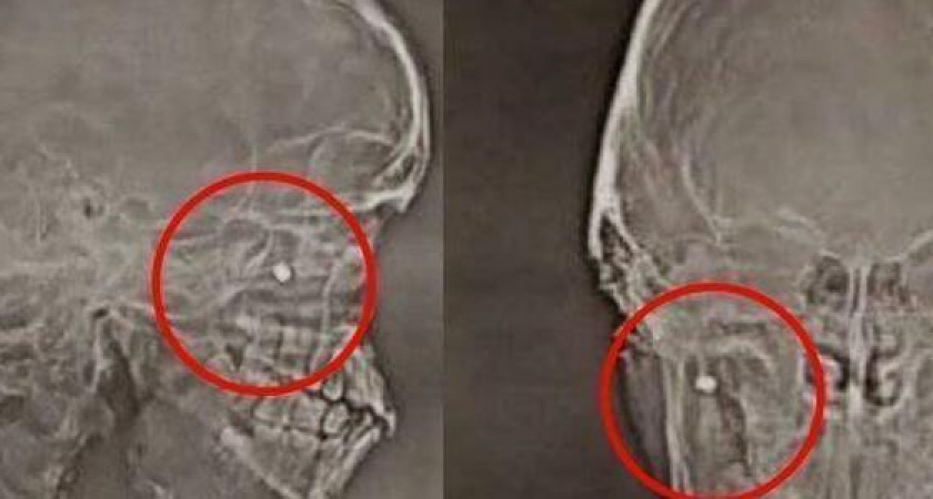 Пуля из пневмата попала школьнику в щеку при сдаче ГТО в Новороссийске