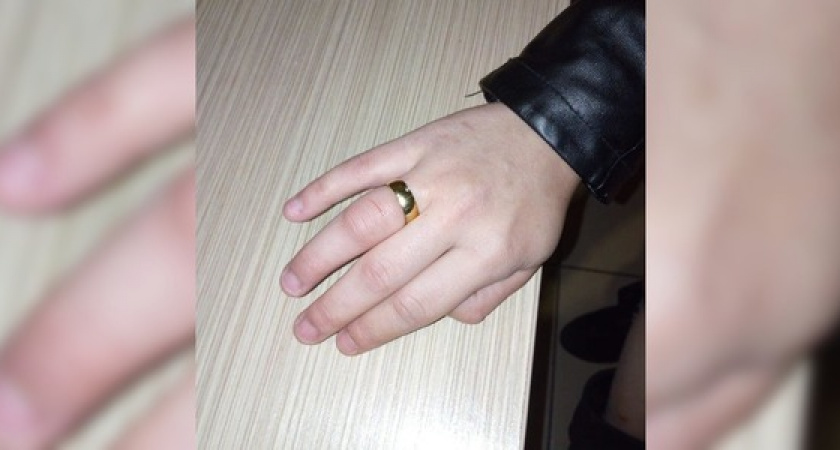 Спасатели сняли кольцо с распухшего пальца жительницы Новороссийска, которое она купила на АлиЭкспресс