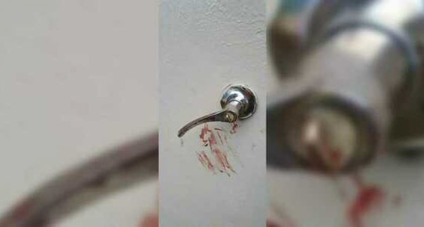 В пригороде Новороссийска нашли окровавленное тело пенсионерки