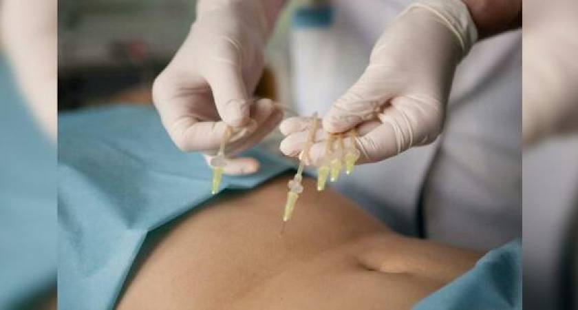 Вирус не пройдет: укрепляем иммунитет с помощью озонотерапии