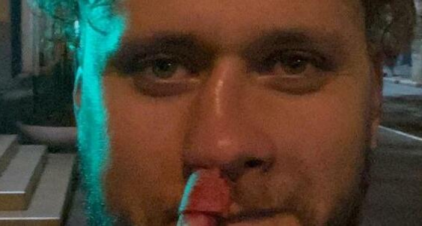 Солисту кавер-группы «Бакс Бани» сломали нос во время концерта в Геленджике