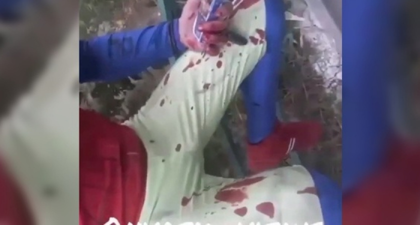 «Звезда планеты Новороссийск»: в Сети появилось видео, на котором  жених-Спайдермен из передачи «Давай поженимся» весь в крови прикован к уличному ограждению