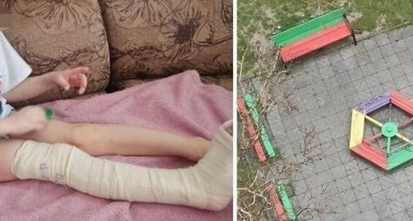 Опасные качели: в Новороссийске 4-летний ребенок сломал ногу на детской площадке
