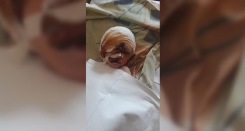 «Собака разодрала моему Петру лоб от виска до виска», - мама 6-летнего новороссийца о жутком нападении пса на ребенка