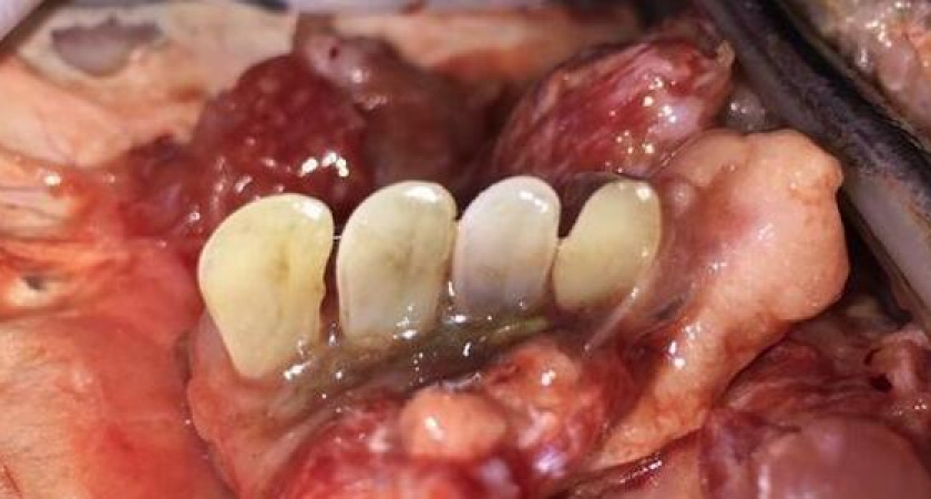 «Как человеческие!» Новороссийцы купили на рынке толстолобика с зубами