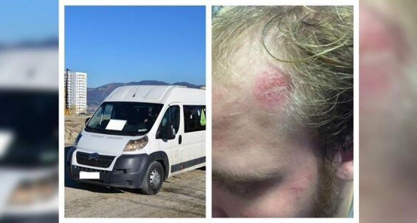 Из-за неоплаченного проезда водитель новороссийской маршрутки избил молодого человека