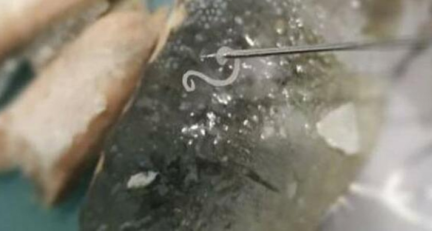 «Черви везде!»  Новороссийцы нашли паразитов в купленной рыбе