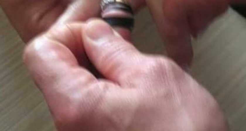 Новороссийские спасатели при помощи мыла и нитки помогли беременной девушке снять кольцо