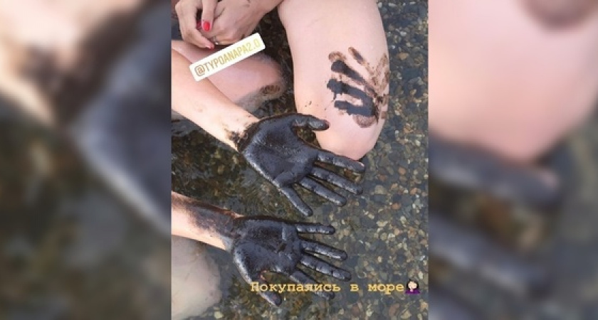 В Анапе детей отмывали бензином после купания в море