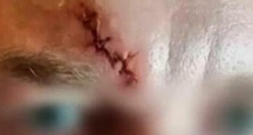 5 швов и сотрясение мозга: житель Новороссийска заявил, что был избит сотрудниками ЧОП в магазине