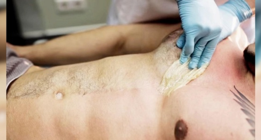 Мужской шугаринг: как решиться на процедуру? 5 причин «за»