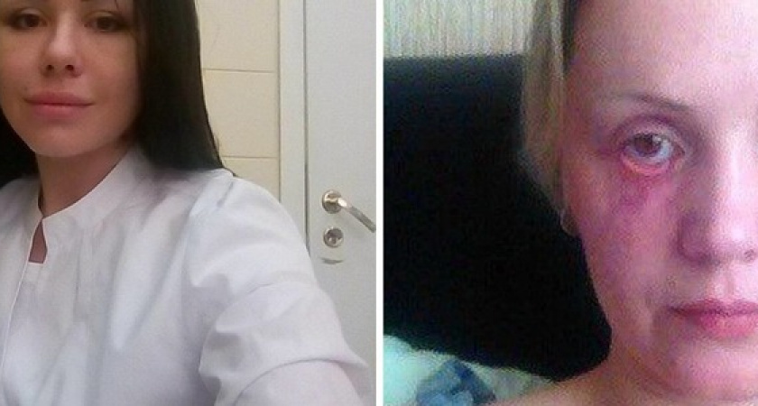 «Я очнулась в кладовке. Операция уже заканчивалась»: жительница Новороссийска рассказала, как стала жертвой пластического хирурга-самоучки
