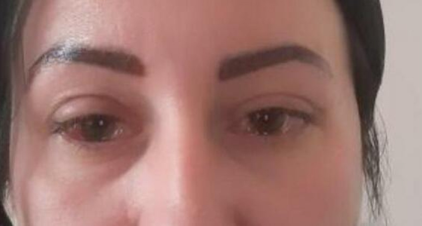 "Я почувствовала жуткую боль и резь!": жительница Новороссийска получила ожог глаз второй степени в тату-салоне