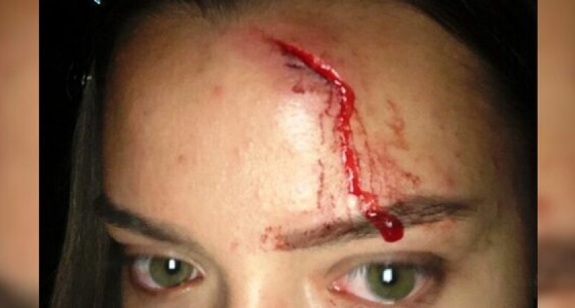 Подозреваемый в избиении сотрудницы тира в Анапе будет помещен в СИЗО Новороссийска