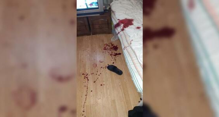 Новороссиец устроил кровавую бойню за оскорбление. Один оппонент умер, второй – в реанимации