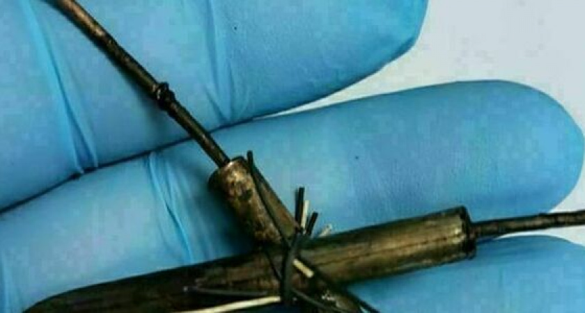 Хирурги Новороссийска извлекли из пищевода заключенного провод от кипятильника (он  его проглотил)