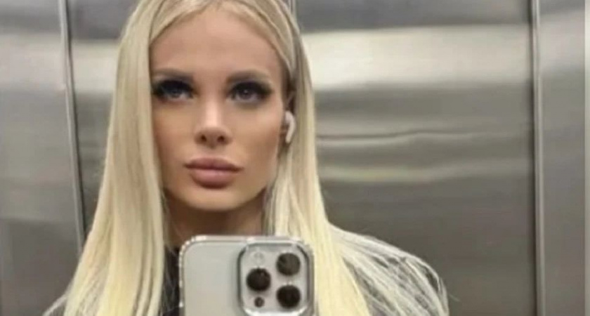 Модель из Краснодарского края жестоко избили в Москве: девушке «пробили голову», она находится в реанимации и почти ничего не помнит