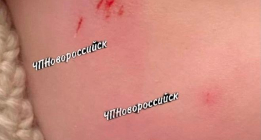 В Новороссийске еще одна сосулька упала на маму с маленьким ребенком: у малышки ссадины и отек на лице 