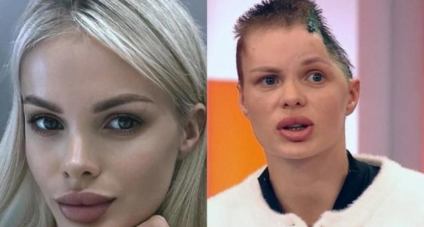 Модель из Краснодара, которой бывший парень снес полчерепа, требует для него реального срока 