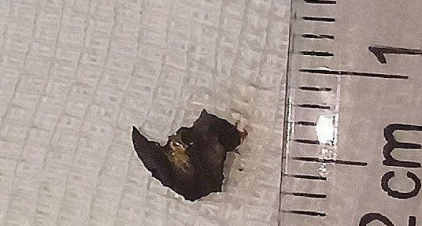 Новороссийцу при покосе травы в глаз попал сантиметровый кусок металла