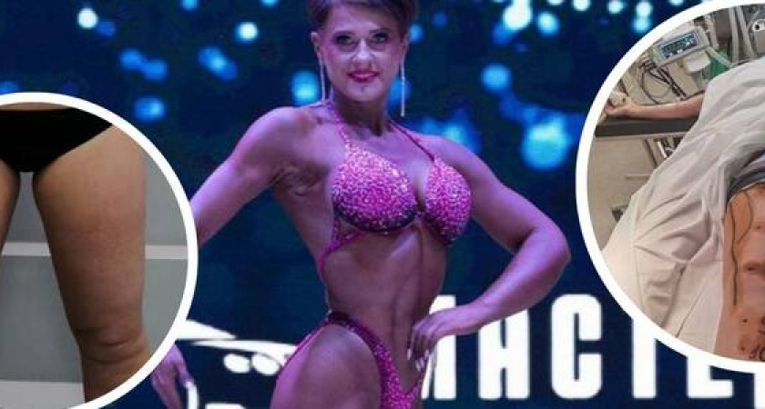 "Предательство хуже болезни":  жительница Новороссийска преодолела рак 3-ей стадии, рассталась с мужем и стала бодибилдером