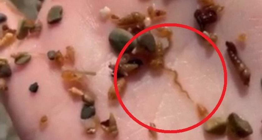 Паразиты наступают: в Новороссийске женщина обнаружила «глиста» на городском пляже