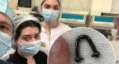 В Новороссийске из пищевода малыша достали «подковку» при помощи «крысиного зуба»