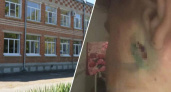 Детская поножовщина: на Кубани школьник воткнул нож в ухо старшеклассника