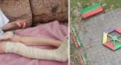 Опасные качели: в Новороссийске 4-летний ребенок сломал ногу на детской площадке