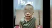 Прокуратура Новороссийска внесла представления мэру города и главе полиции после жестокого избиения 6-летнего ребенка собственной матерью