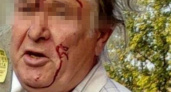 «Ему не понравился цвет ее одежды»: в Новороссийске мужчина ударил 11-летнюю девочку кулаком в лицо