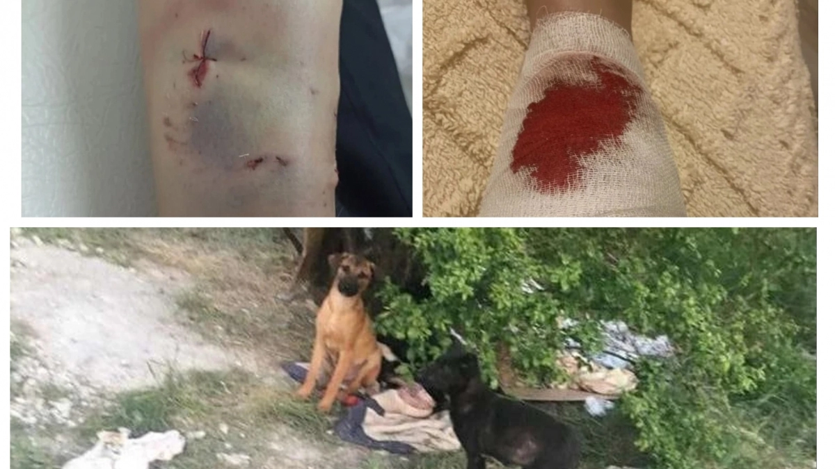 В Борисовке под Новороссийском агрессивная собака продолжает нападать на людей 