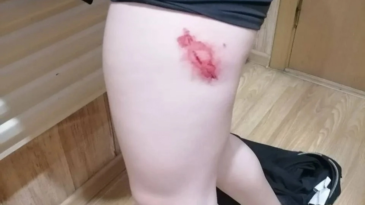 Под Новороссийском собака напала на девушку, повалила на землю и начала грызть